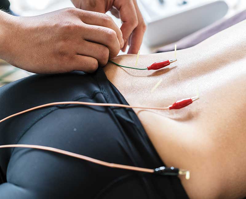 BLOGPOST_ElectroAcupuncture08262019_s.jpg