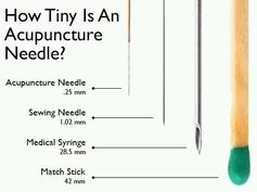 TREATMENTS_AcupunctureNeedleSizing.jpg