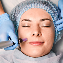 Medical Microneedling